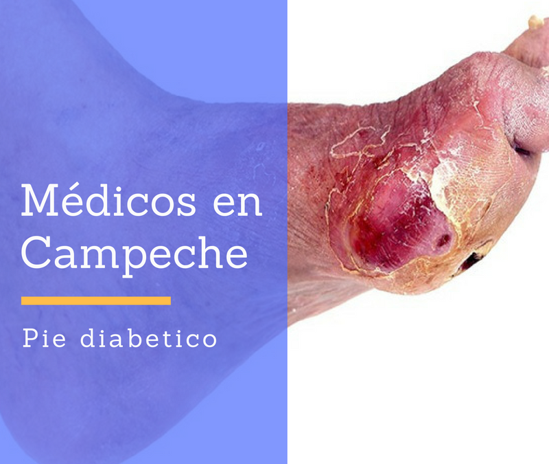 Pie diabetico